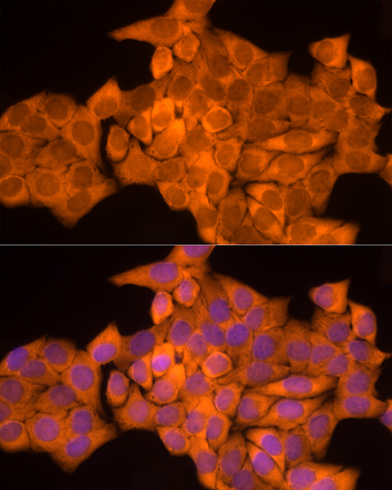 NAT1 Rabbit monoclonal antibody