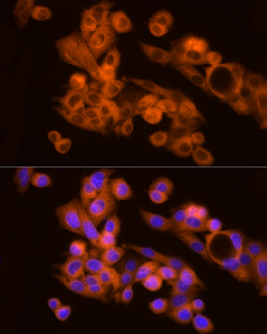 NAT1 Rabbit monoclonal antibody