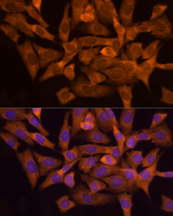 NAT1 Rabbit monoclonal antibody