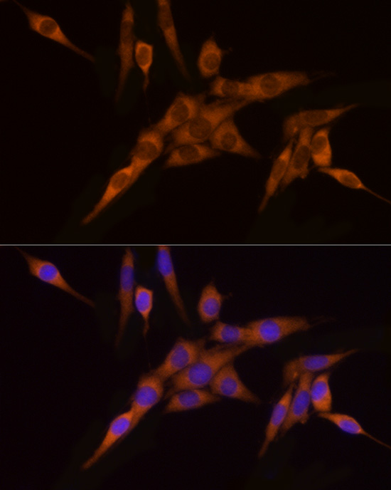 NAT1 Rabbit monoclonal antibody
