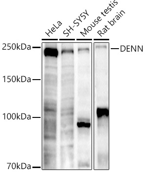 DENN Rabbit monoclonal antibody