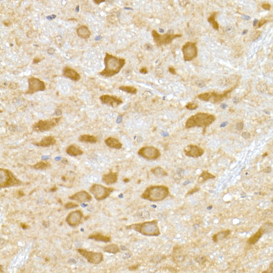 DENN Rabbit monoclonal antibody