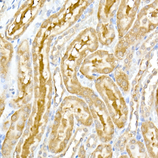 DENN Rabbit monoclonal antibody