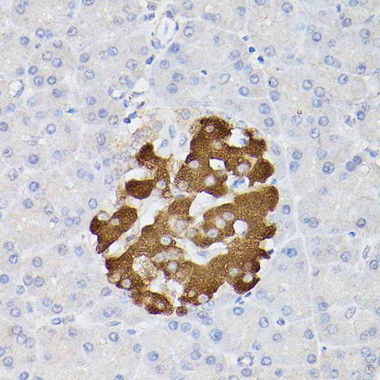 Insulin Rabbit polyclonal antibody