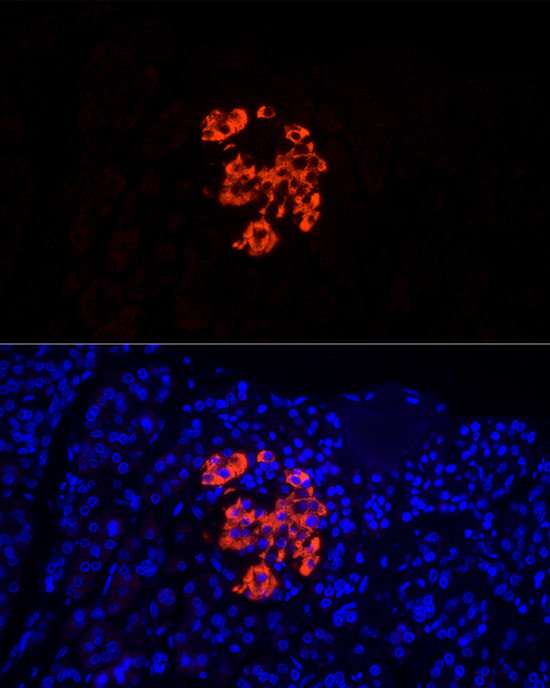 Insulin Rabbit polyclonal antibody