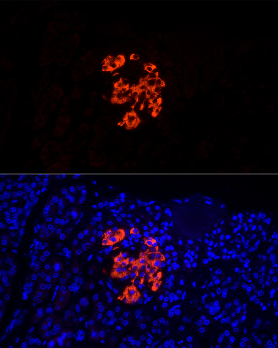 ABclonal:Immunofluorescence - Insulin Rabbit pAb (A2090)