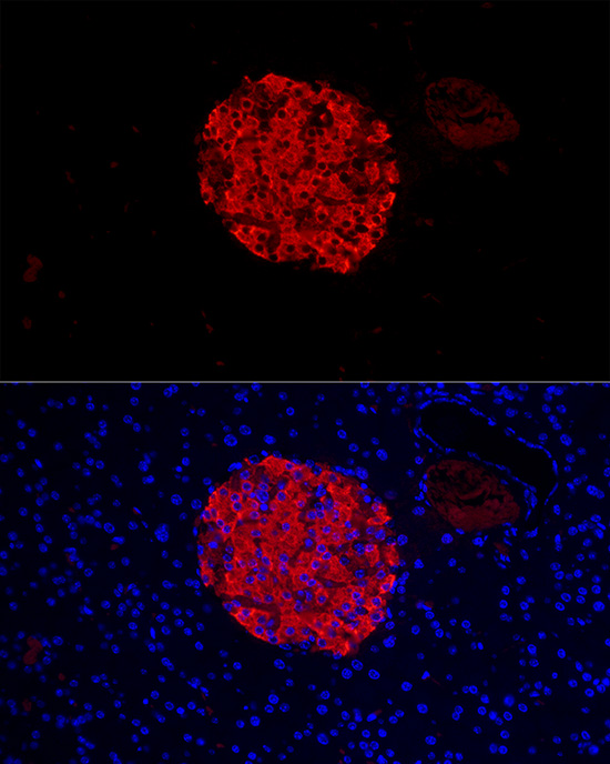 Insulin Rabbit polyclonal antibody