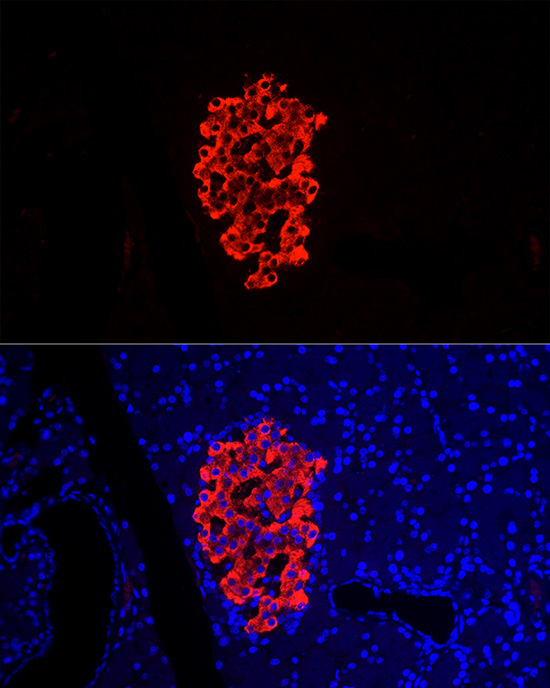 Insulin Rabbit polyclonal antibody