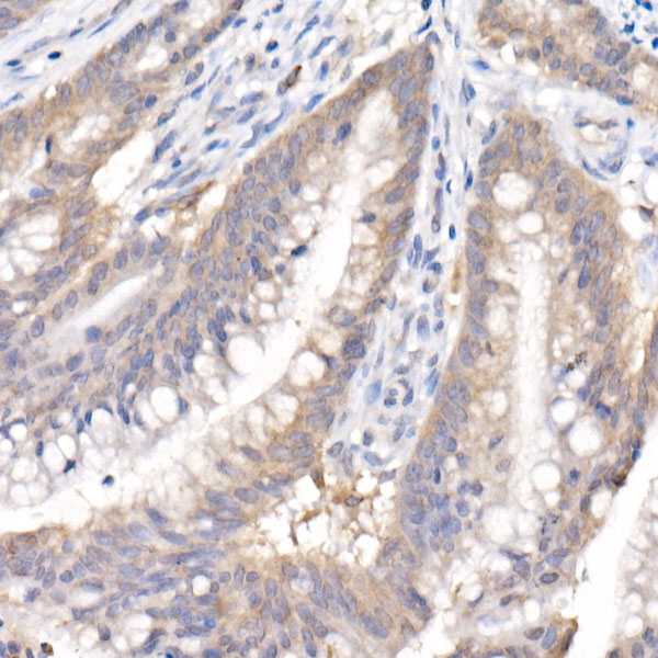 SARA Rabbit monoclonal antibody