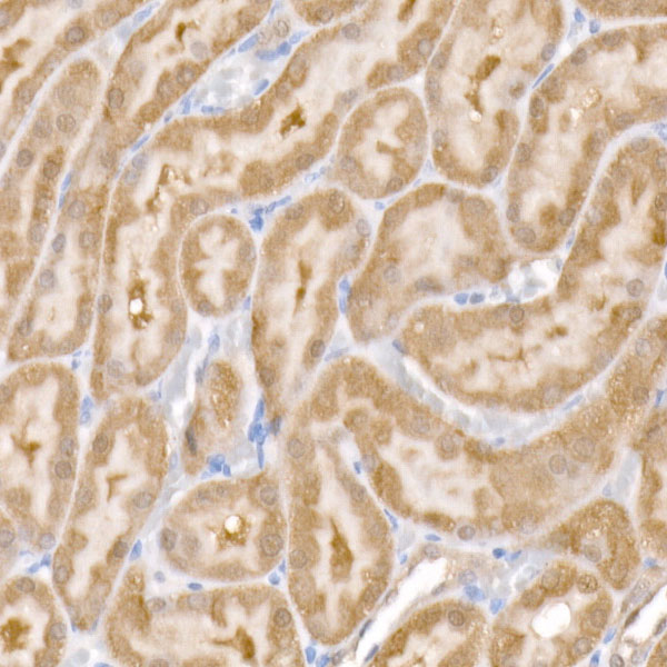 SARA Rabbit monoclonal antibody