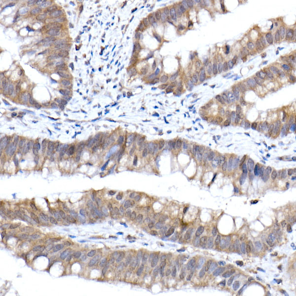 Importin 9 / RANBP9 Rabbit monoclonal antibody