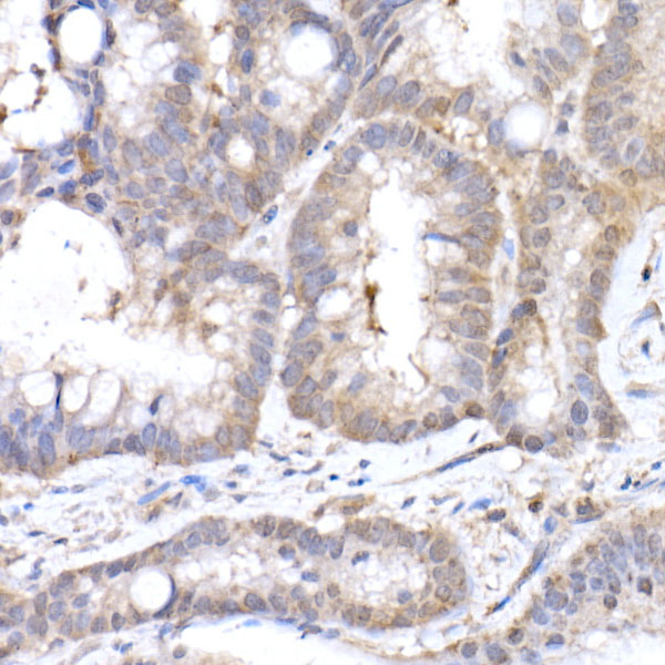 MTAP Rabbit monoclonal antibody