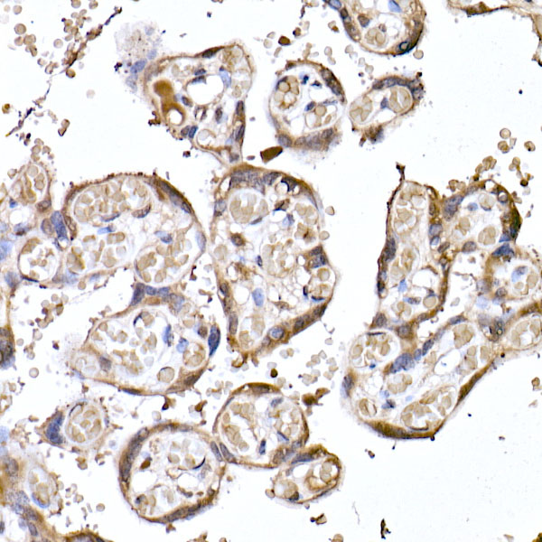 MTAP Rabbit monoclonal antibody