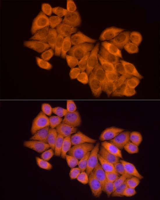 MTAP Rabbit monoclonal antibody