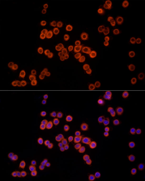 MTAP Rabbit monoclonal antibody