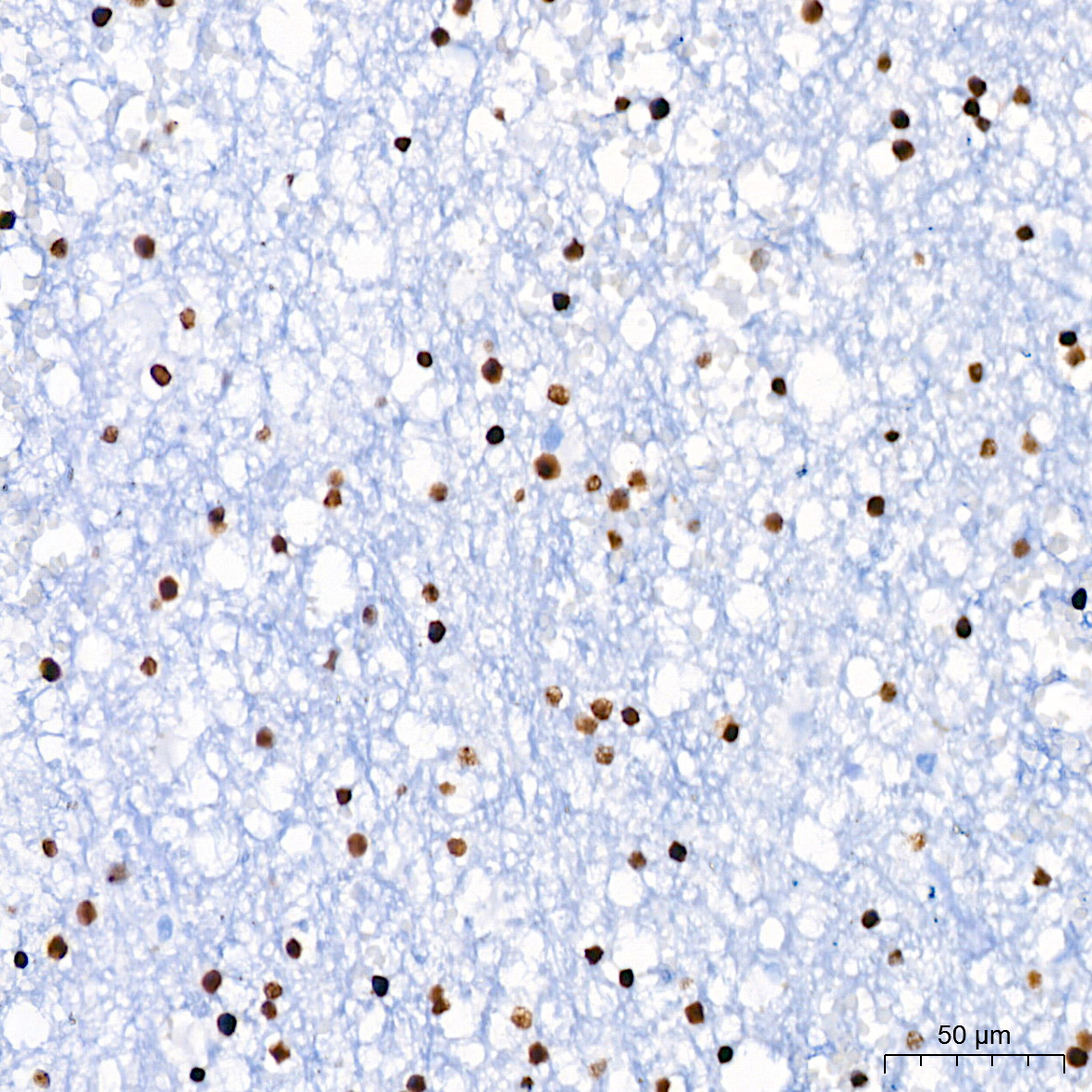 Nucleolin Rabbit monoclonal antibody