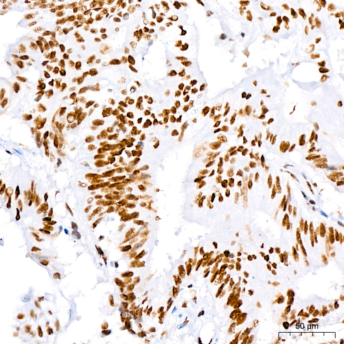 Nucleolin Rabbit monoclonal antibody