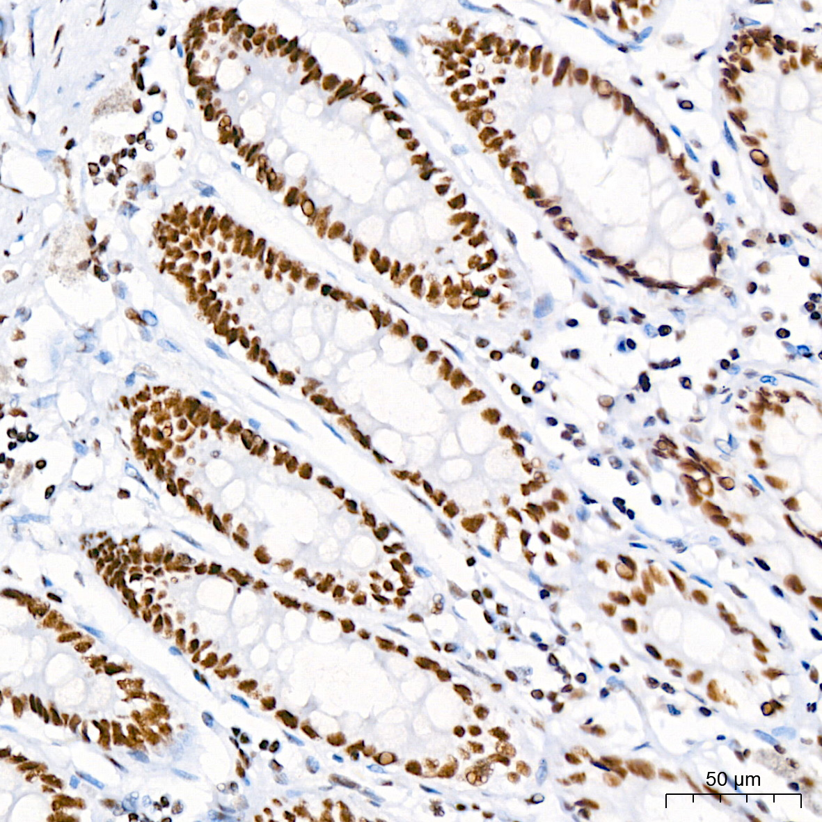 Nucleolin Rabbit monoclonal antibody
