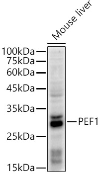 PEF1 Rabbit monoclonal antibody