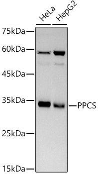 PPCS Rabbit monoclonal antibody