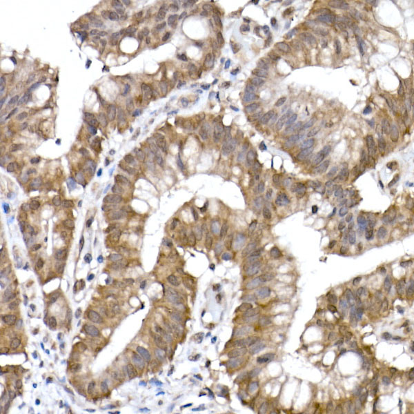 PPCS Rabbit monoclonal antibody