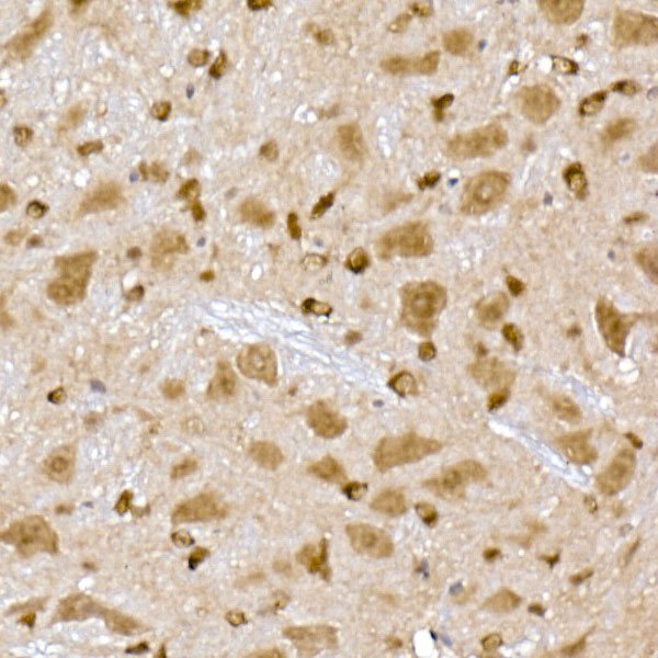PPCS Rabbit monoclonal antibody