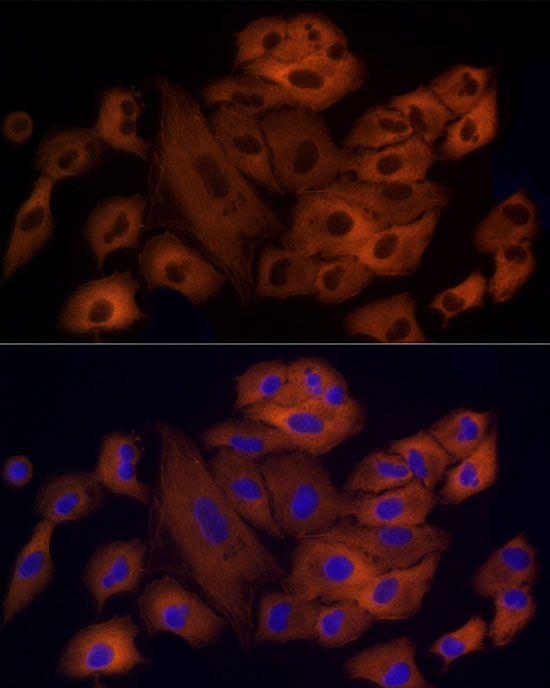 OXGR1 / GPR99 Rabbit monoclonal antibody