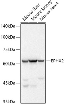 EPHX2 Rabbit monoclonal antibody