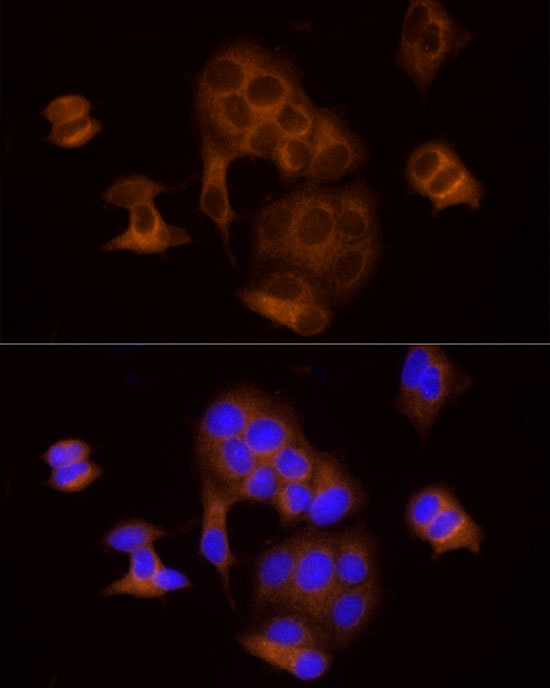 DTYMK Rabbit monoclonal antibody