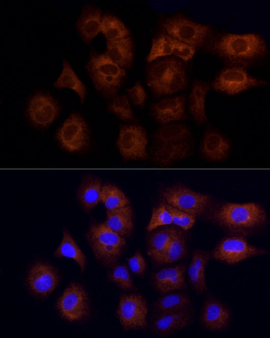 CYFIP1 Rabbit monoclonal antibody