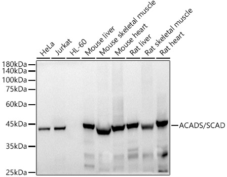 ACADS / SCAD Rabbit monoclonal antibody