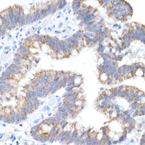 ACADS / SCAD Rabbit monoclonal antibody