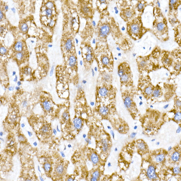 ACADS / SCAD Rabbit monoclonal antibody