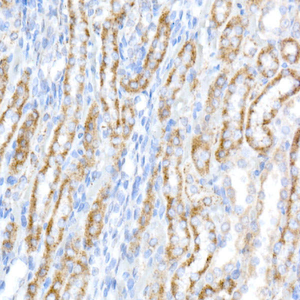 ACADS / SCAD Rabbit monoclonal antibody