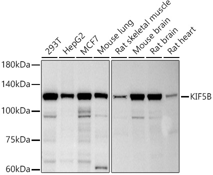 KIF5B Rabbit monoclonal antibody