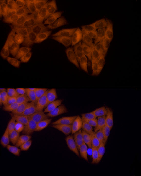 KIF5B Rabbit monoclonal antibody