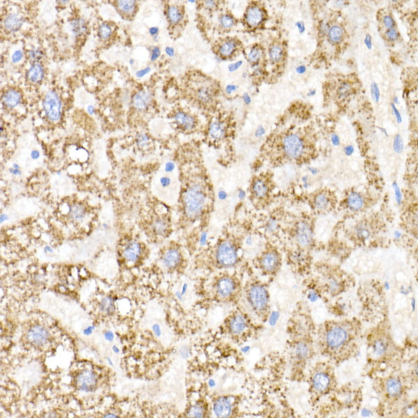 GNAI2 Rabbit monoclonal antibody