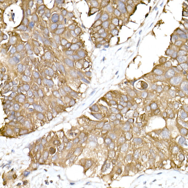 GNAI2 Rabbit monoclonal antibody