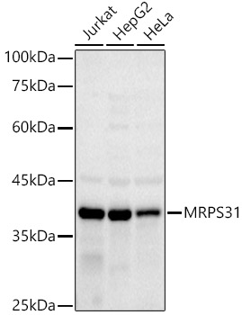 MRPS31 Rabbit monoclonal antibody