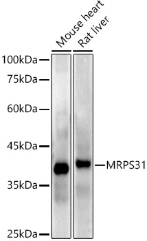 MRPS31 Rabbit monoclonal antibody