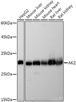 [KO Validated] AK2 Rabbit monoclonal antibody