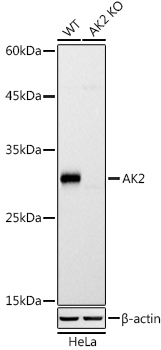 [KO Validated] AK2 Rabbit monoclonal antibody