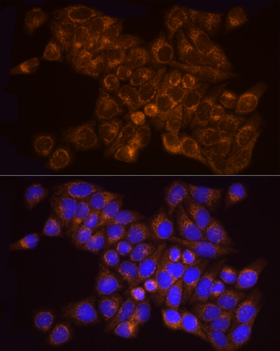 [KO Validated] AK2 Rabbit monoclonal antibody