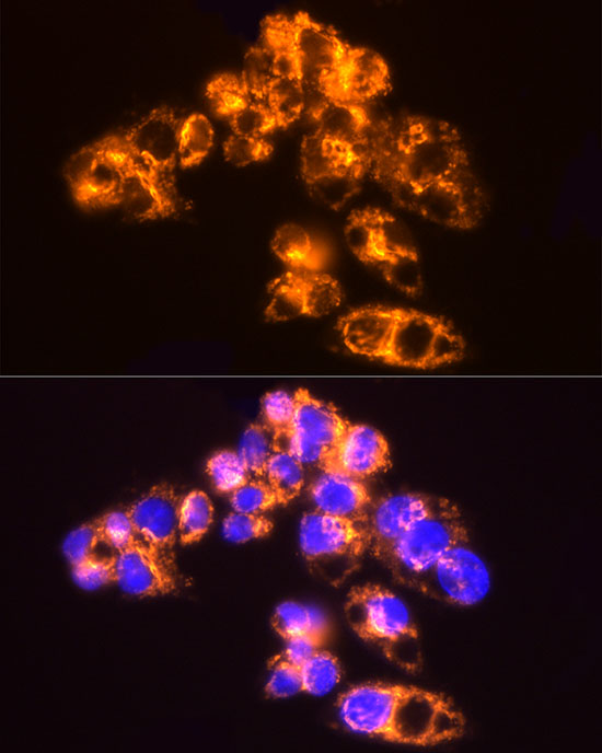 [KO Validated] AK2 Rabbit monoclonal antibody