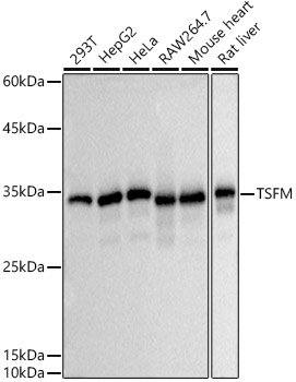 TSFM Rabbit monoclonal antibody
