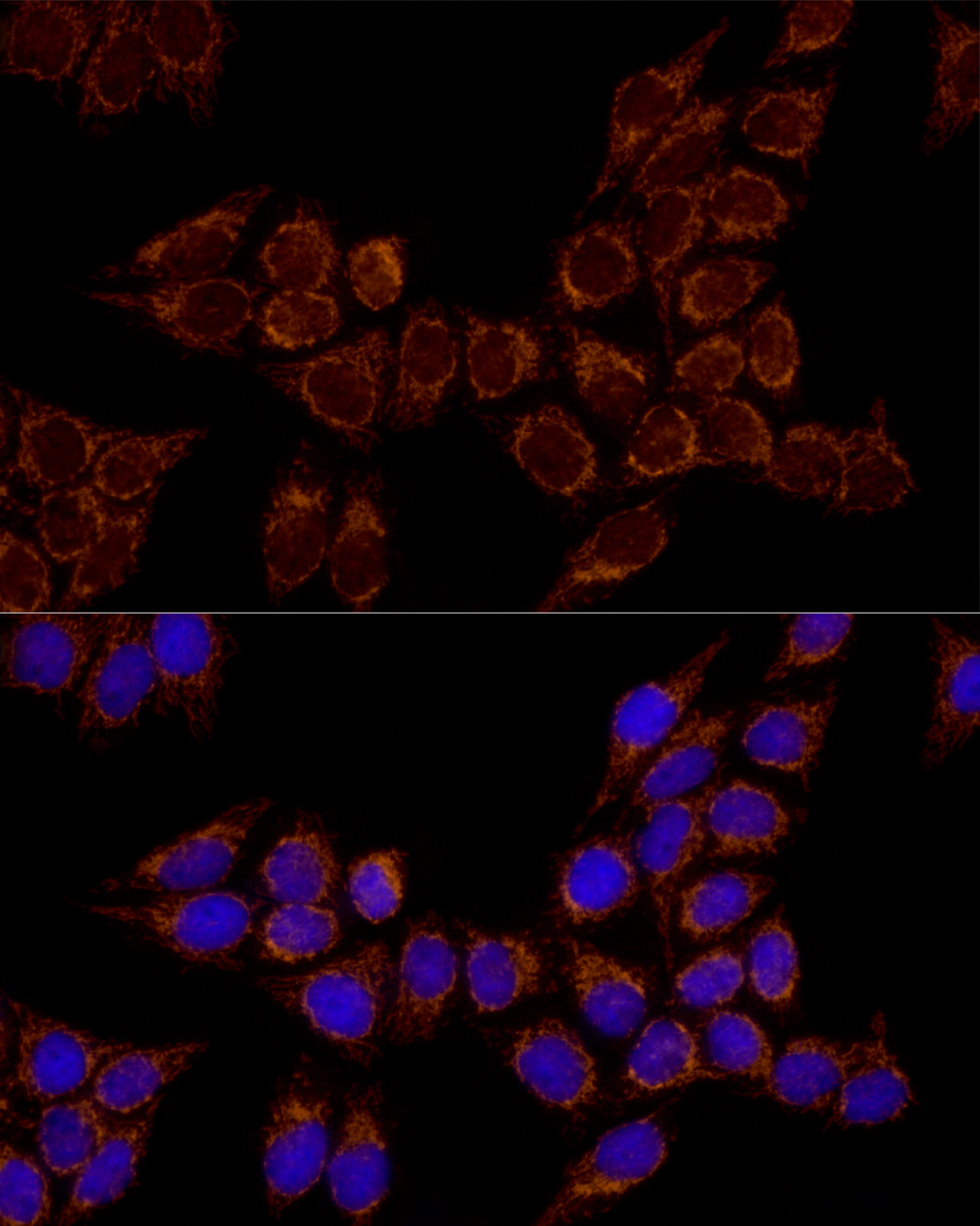 TSFM Rabbit monoclonal antibody