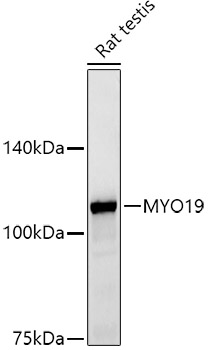 MYO19 Rabbit monoclonal antibody