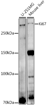 Ki67 Rabbit polyclonal antibody