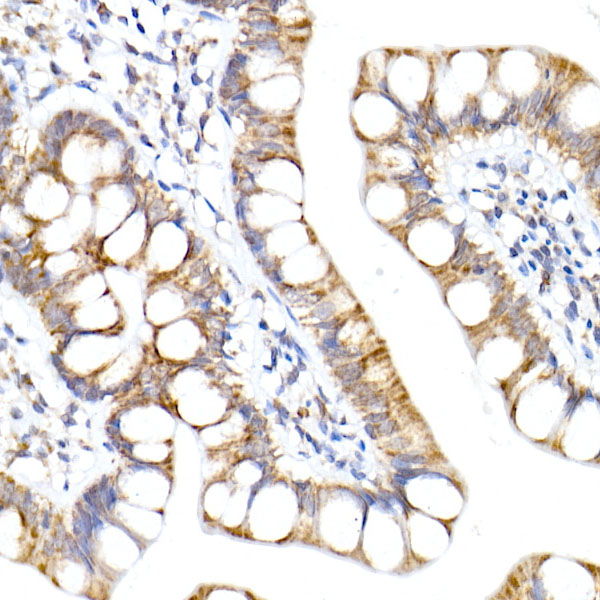 NDUFA1 Rabbit monoclonal antibody
