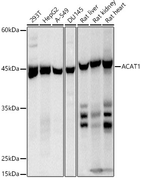 ACAT1 Rabbit monoclonal antibody